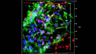 ZEISS Lightsheet Z1 Hepatocyte Spheroid Imaging [upl. by Yggam]