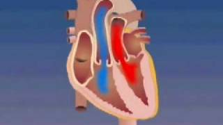 Transposition of the Great Arteries [upl. by Eineg]