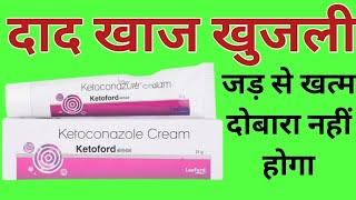 Ketoford Cream Uses  Ketoconazole Cream  दाद खाज खुजली फंगल इन्फेक्शन जड़ से ठीक करे [upl. by Htabazile]