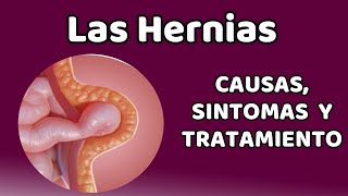 ¿Qué es y cómo se trata una hernia umbilical [upl. by Neelyk]