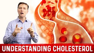 How to Read and Understand Your Cholesterol Levels [upl. by Navnod]