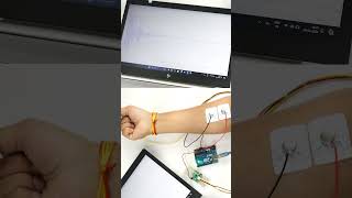 Visualise muscle signals using mikroBUS compatible EMG sensor emg sensor arduino diyprojects [upl. by Nilam]