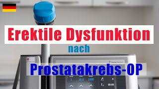 ED nach ProstatakrebsOP diese Dinge müssen Sie vorher wissen  Urologe Göttingen [upl. by Anevad]