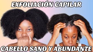 EXFOLIACIÓN CAPILAR PARA EL CRECIMIENTO DEL CABELLO AFRO  CÓMO ELIMINAR LA CASPA  RIHANEL [upl. by Enaed]