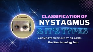 Nystagmustypes of nystagmus pathologicalphysiologicalspasmus nutons Opt orthoptistes [upl. by Madai]