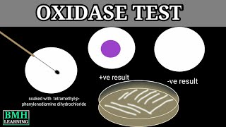 Oxidase Test [upl. by Nomyar6]