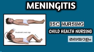 Meningitis Malayalam  Etiology Symptoms Diagnosis amp Treatment  3rd Year BSc Nursing Lecture CHN [upl. by Brendon]