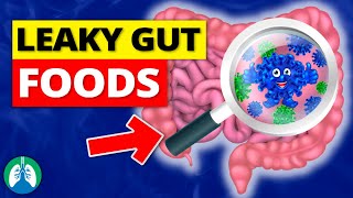 Top 10 Foods That Can Cause a Leaky Gut MUST AVOID [upl. by Leona]