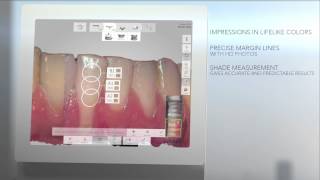 3Shape TRIOS 3 Oral Scanner [upl. by Leissam]