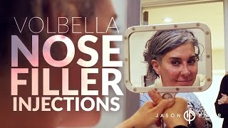 Nose Job Without Surgery With Volbella Filler amp Syringe  Nose Reshaping  Dr Jason Emer [upl. by Frasch257]