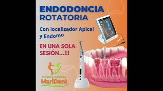 Endodoncia [upl. by Aenyl]