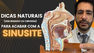 Dicas naturais para acabar com a sinusite [upl. by Eislel]