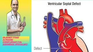 VENTRICULAR SEPTAL DEFECT BY DRSUMIT TYAGISUMITMEDICALDISPENSARY1 [upl. by Lear]