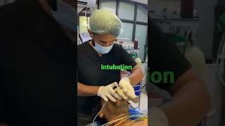 endotracheal intubation [upl. by Dlorej]