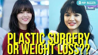 AOA Jimin Had Plastic Surgery [upl. by Celestyna]