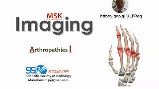 Arthropathies  part 1  Profmamdouh Mahfouz 2019 edition [upl. by Aisorbma]