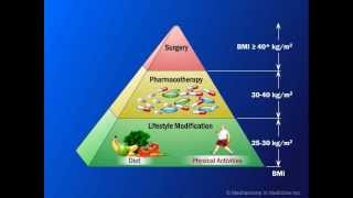 Current Management of Obesity [upl. by Hinkle]