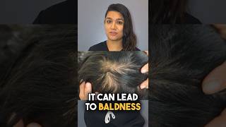 Female Hair Loss Triggering Factors Explained by Dr Aleena [upl. by Hibbs]