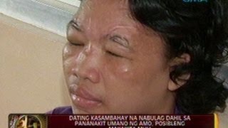 24 Oras Dating kasambahay na nabulag dahil sa pananakit umano ng amo posibleng makakita muli [upl. by Nigel82]