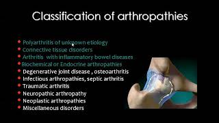 Arthropathies part 2  Profmamdouh Mahfouz 2019 edition [upl. by Nivrek680]