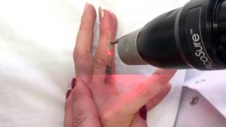 Премахване на татуировка с PicoSure  Tattoo removal with PicoSure [upl. by Larimer]