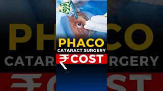 Phaco Cataract Surgery Cost [upl. by Colt]