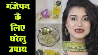 Home Remedy for Baldness Hindi [upl. by Doran]