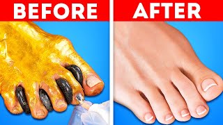 Time for AtHome Foot Therapy Hacks 🦶 Natural amp Affordable Tips for Healthy Happy Feet [upl. by Daniele]