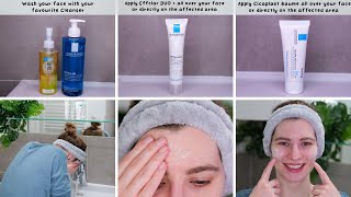 How to use La Roche Posay Effaclar DUO  and Cicaplast Gel B5 [upl. by Tonya]