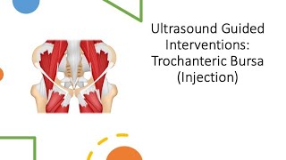 ultrasound Guided Interventions Trochanteric Bursa Injection fyp sport sports sportsmedicine [upl. by Netnerb]