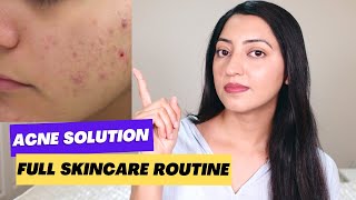 Complete Skincare Routine for Acne [upl. by Other]