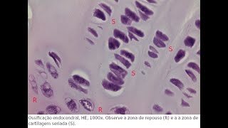 925  ATTO  Ossificação endocondral [upl. by Zumwalt]