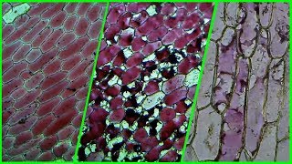 Osmosis in Red Onion Cells [upl. by Aicia]