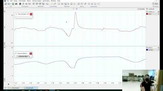 Spirometry demonstration [upl. by Feilak602]