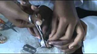 How to Dissect a Cows Eye  eContent Biology Resource [upl. by Neelav]