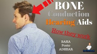 How Bone Conduction Hearing Aids Work  Cochlear BAHA Oticon Medical Ponto Medel ADHEAR [upl. by Klimesh284]