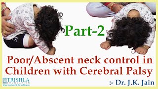 Poor Neck control in Children with Cerebral Palsy treatment amp therapy at Trishla Foundation [upl. by Ender]