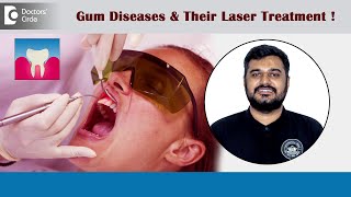 LASER Treatment for Bleeding Gums Gum Diseases amp Gum Pockets  DrParikshith H M  Doctors’ Circle [upl. by Ailaham]