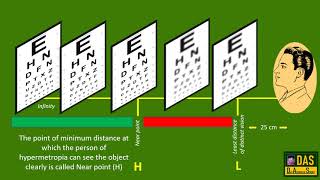 Vision defects of human eye and their corrections [upl. by Home]