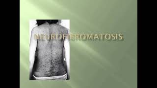 Neurofibromatosis Skin Examination mrcpch Clinical [upl. by Nirol338]