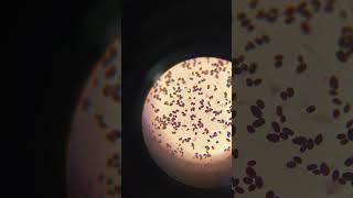 Micrococcus in urine sample gram stain \gram stain in microscope [upl. by Yma135]