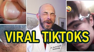 Dermatologists JawDropping Reaction to Amazing Pimple Pops [upl. by Eitten]