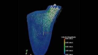 Simulation of blood flow in human heart model [upl. by Anwahsal285]