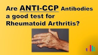 Are anti CCP Antibodies a Good Test for Rheumatoid Arthritis [upl. by Saidnac]