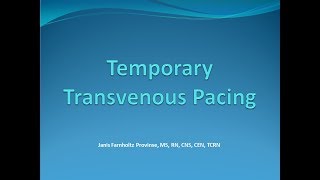 Temporary Tranvenous Pacing [upl. by Are]