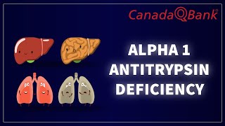 Alpha1 Antitrypsin Deficiency [upl. by Nunnery381]