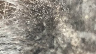 ITCHY DRY FLAKY SCALP  FLAKY DANDRUFF  HAIR SCRATCHING ASMR [upl. by Lebasiram]