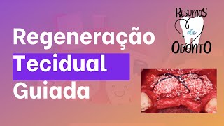 Regeneração tecidual guiada  Resumos de Odonto [upl. by Atteyram]