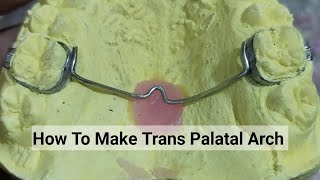 How to Make Transpalatal Arch  TPA orthodontic Appliance By Haider [upl. by Medina]