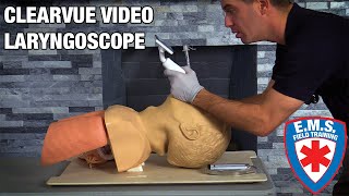 ClearVue Video Laryngoscope Overview [upl. by Enetsirk]